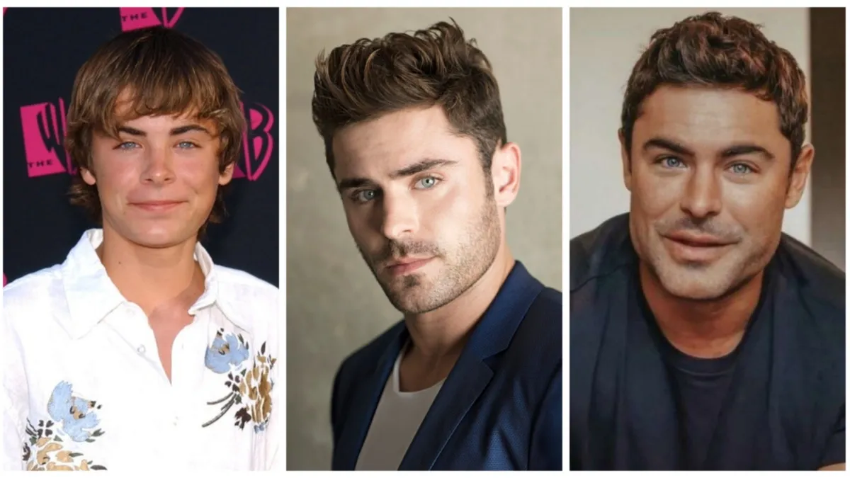 ¿fue Cirugía Zac Efron Rompe El Silencio Sobre La Transformación De Su